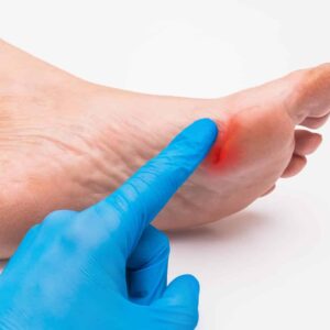 Will My Puncture Wound Heal on Its Own?