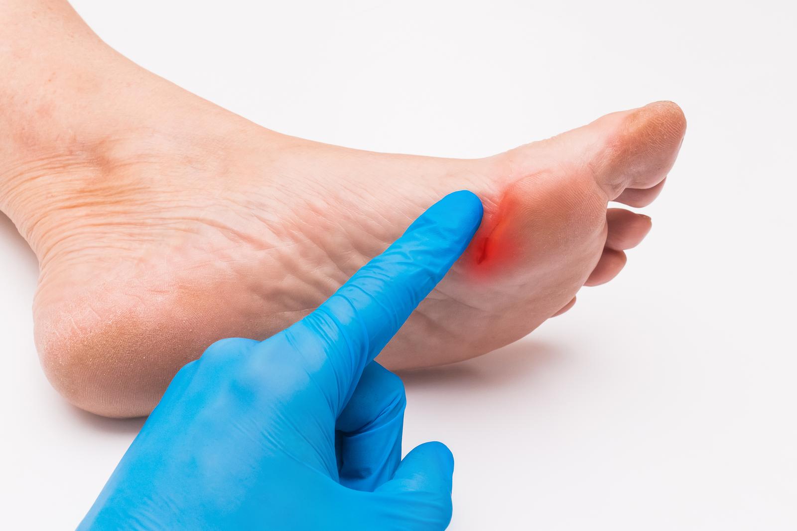 Will My Puncture Wound Heal on Its Own?